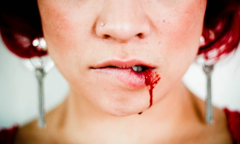 The Justified Bloody Lip